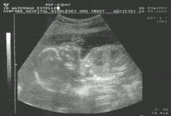 ultrasound 2